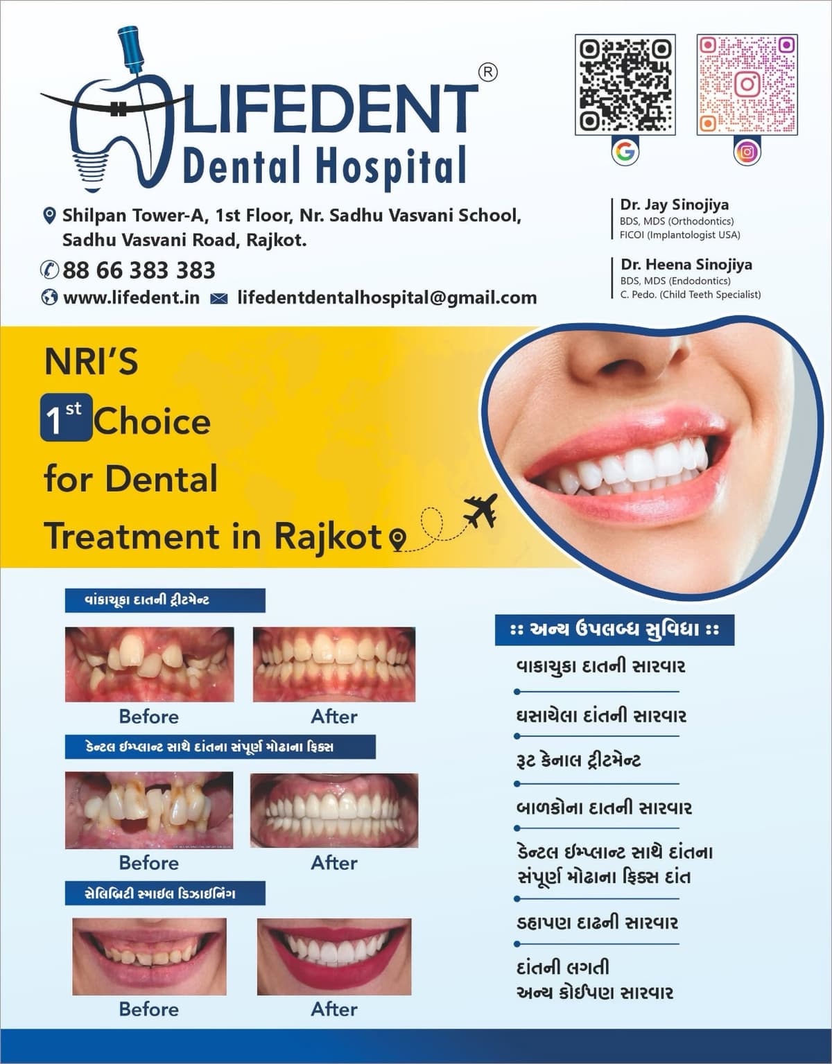Patient smile at Lifedent Dental Hospital, Rajkot 30