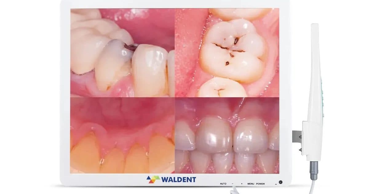 Loose Teeth in Adults: Causes and Treatment