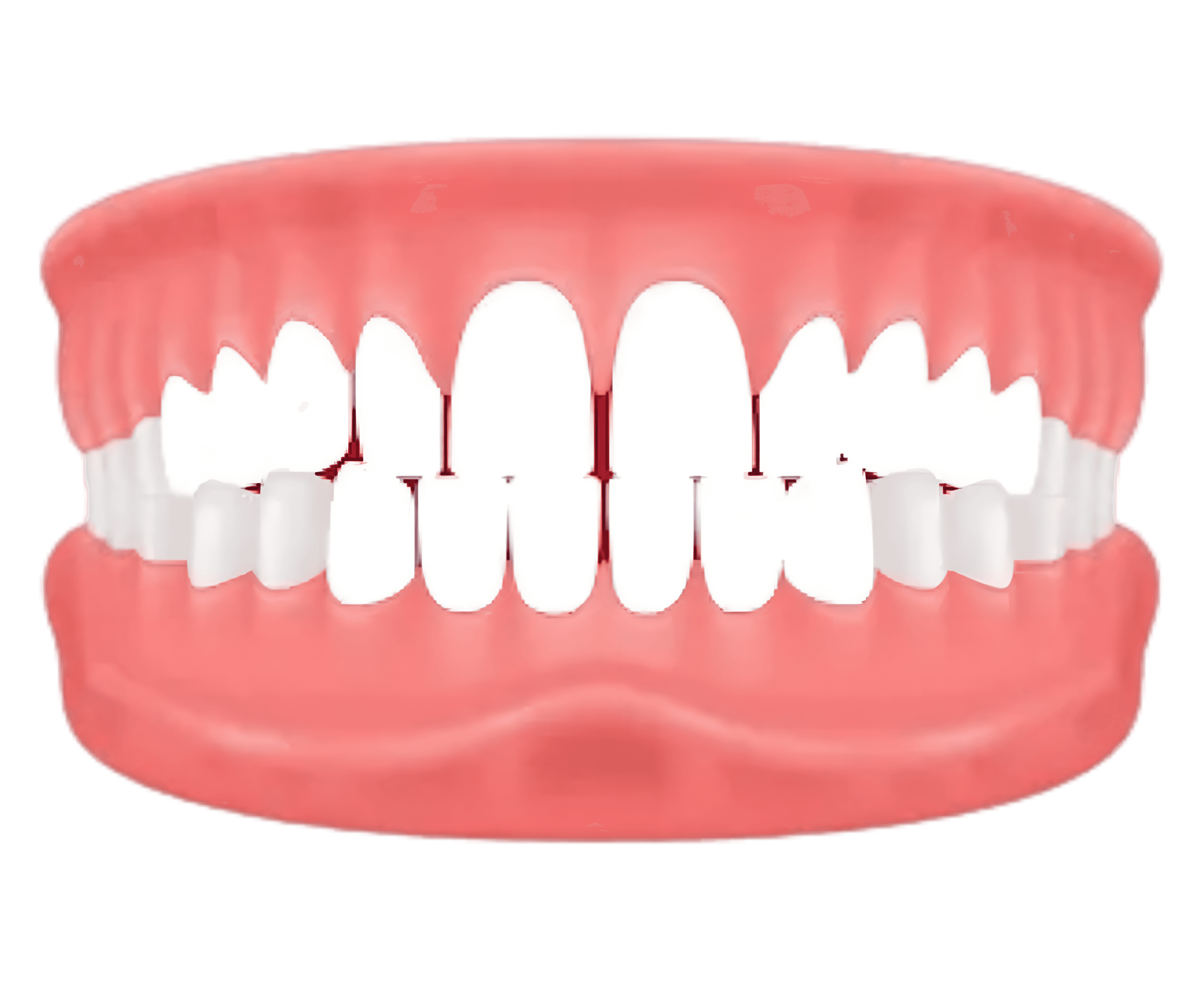 Spacing – gaps between teeth