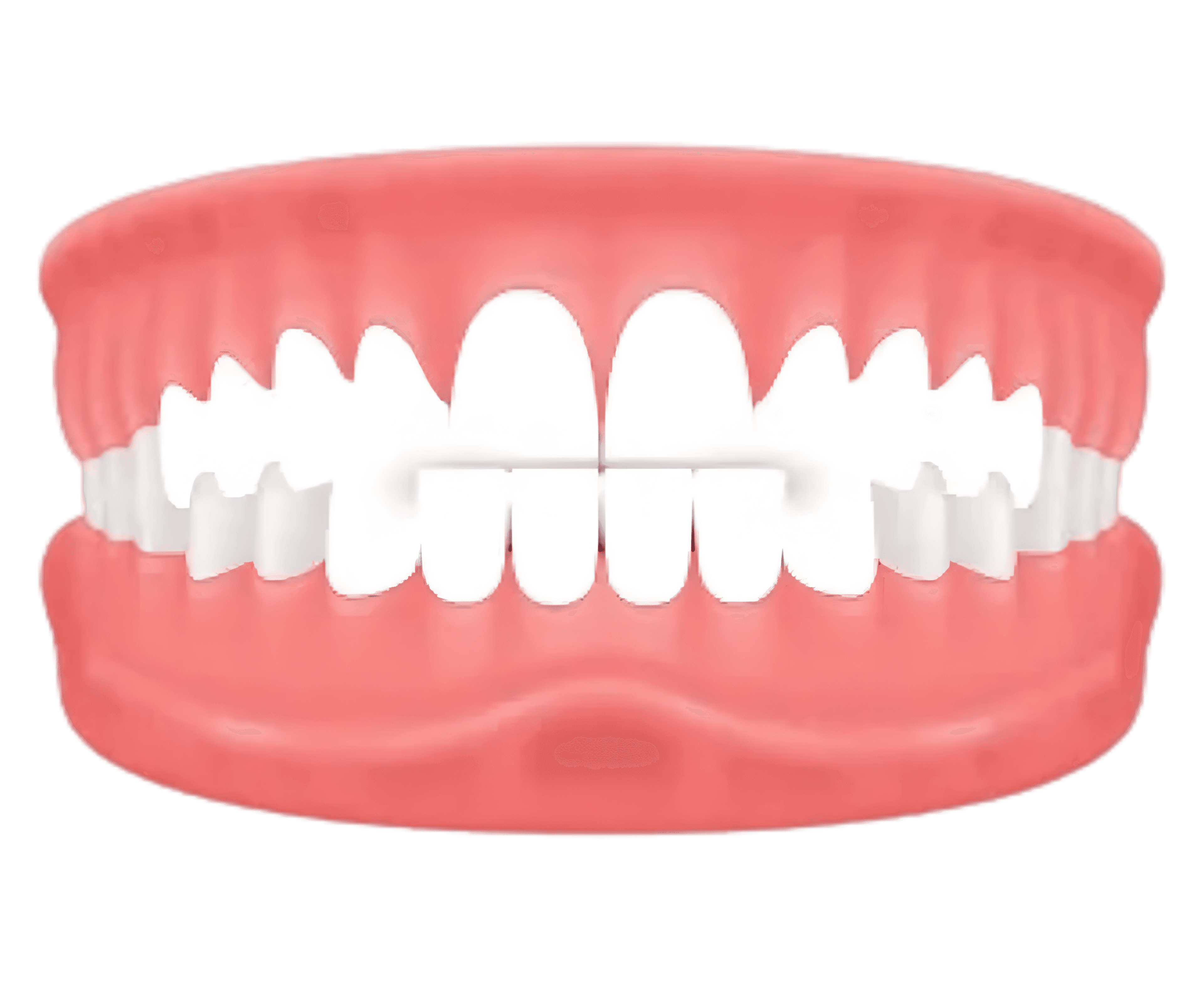 Edge-to-Edge Bite – upper and lower teeth meet directly