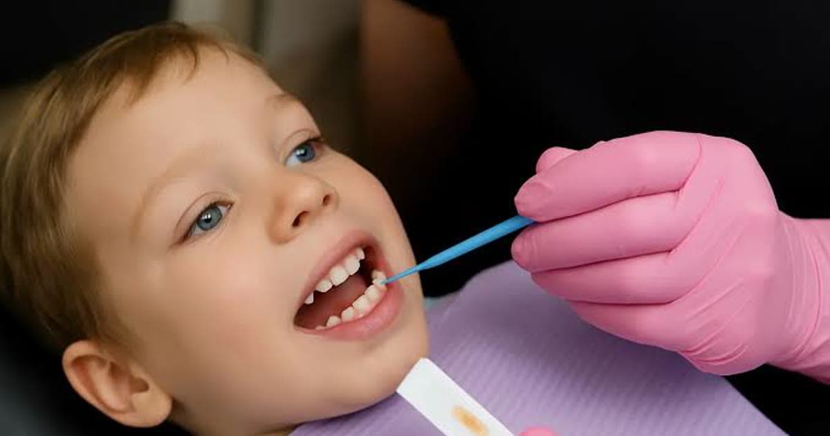 Cavities in Children: How to Prevent Them